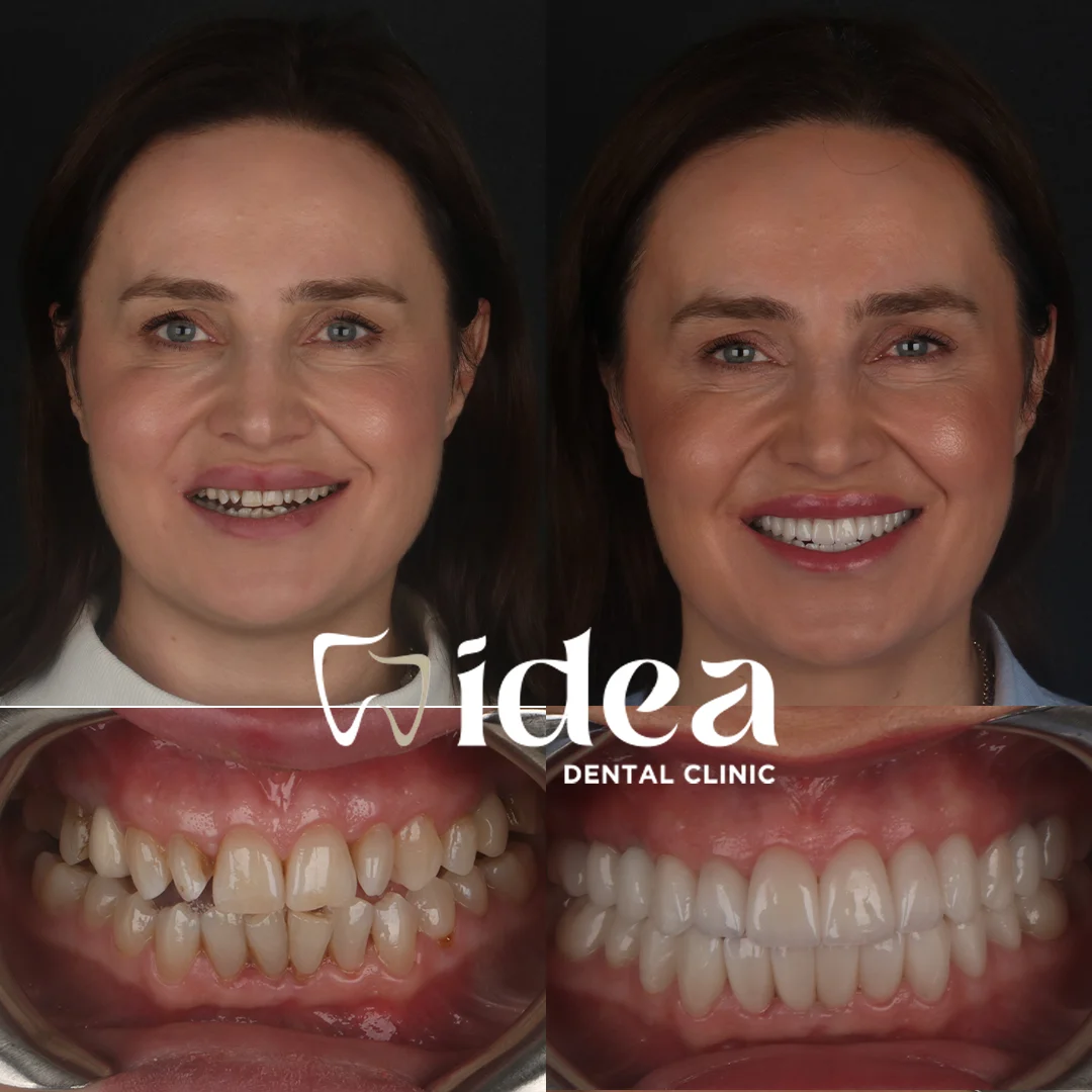Before & After 3