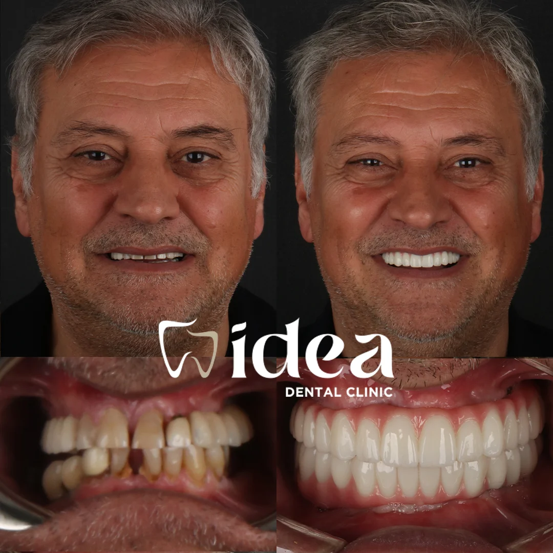 Before & After 8