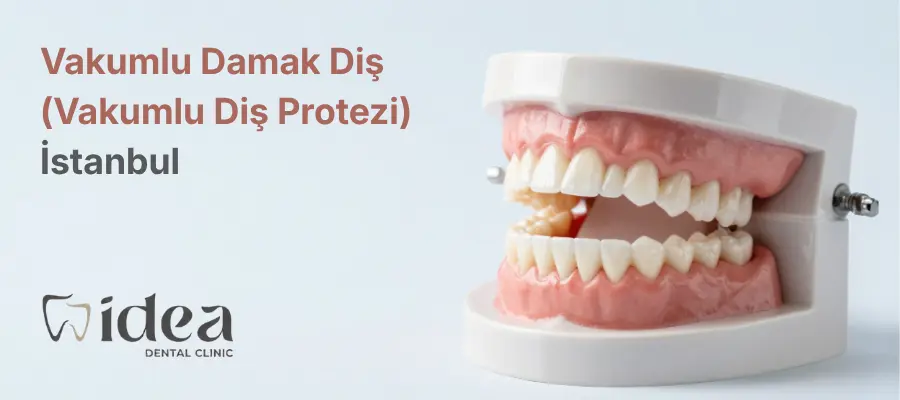 İstanbul’da Vakumlu Damak Diş (Vakumlu Diş Protezi) Rehberi