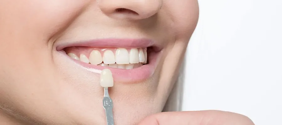 Bonding Application 1 Bonding Application