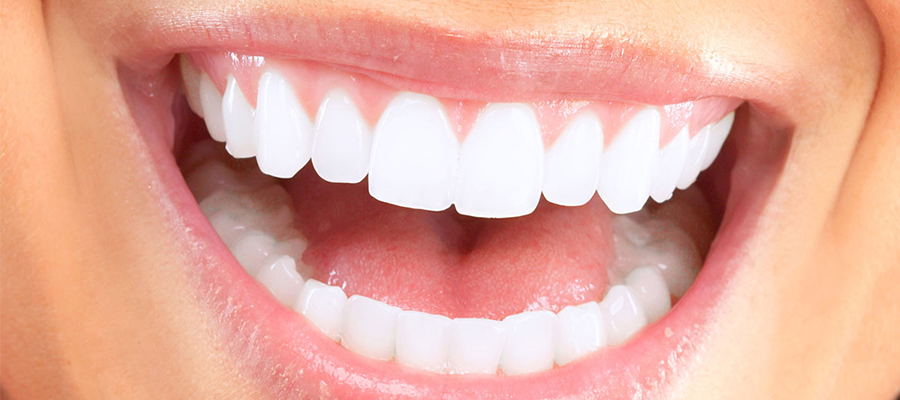 ابتسامة هوليود