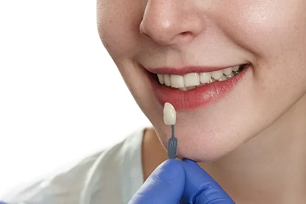 Laminate Veneer Turkey