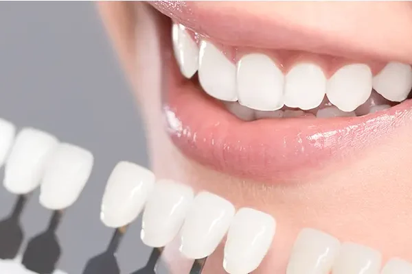 Ламина приложения