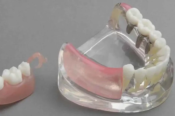 Protez Diş Yutulursa Ne Olur?