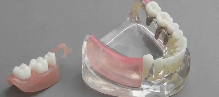 Protez Diş Yutulursa Ne Olur?