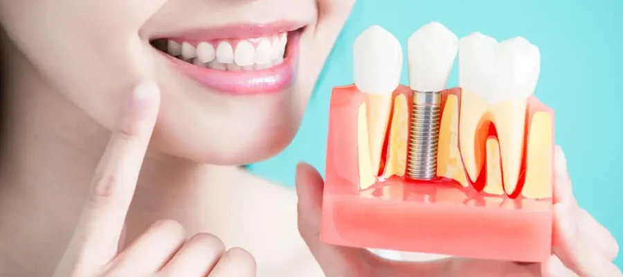 Couronnes dentaires en Turquie