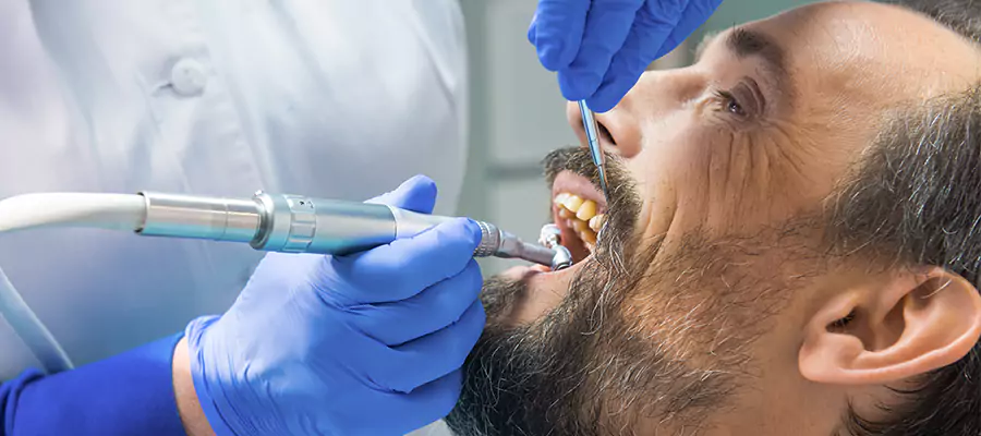 تنظيف أحجار الأسنان في تركيا