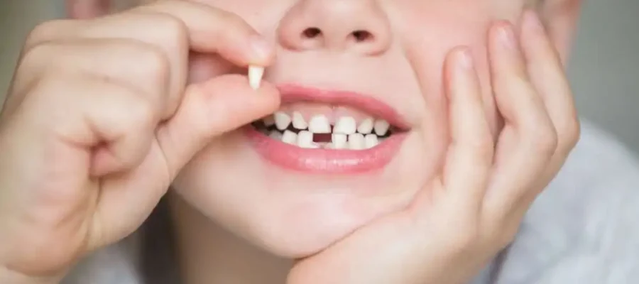 Dökülen Süt Dişinin Yerine Yenisi Ne Zaman Gelir?