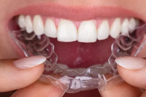 Ставна плоча