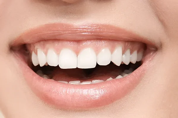 Желирана Усмивка