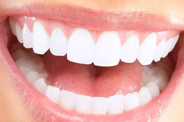 Το χαμόγελο του Χόλιγουντ στην Τουρκία