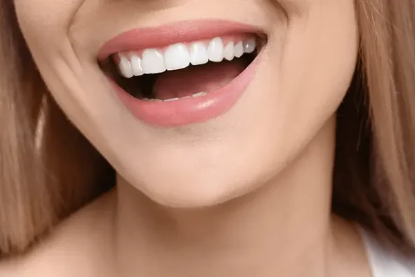 Hollywood Smile Turkey