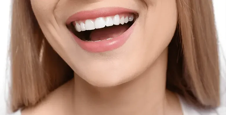 Hollywood Smile Turkey