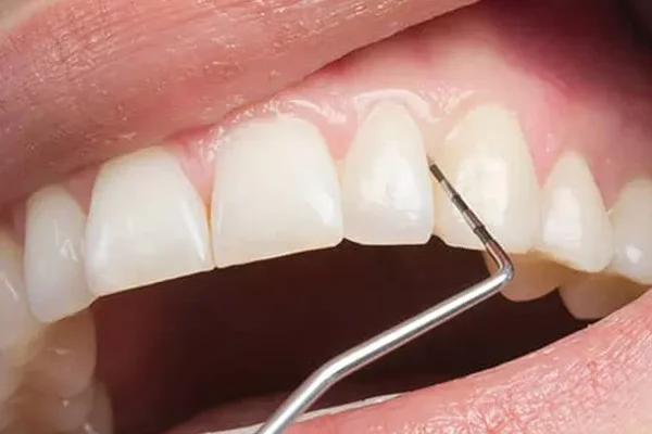 пародонтология