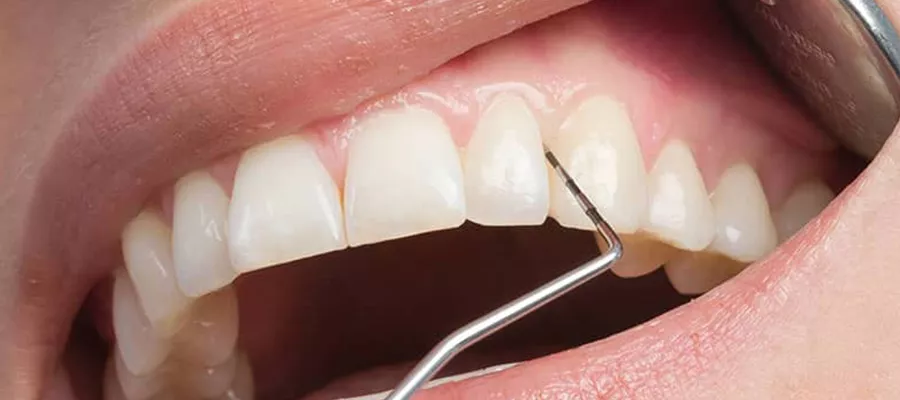 пародонтология