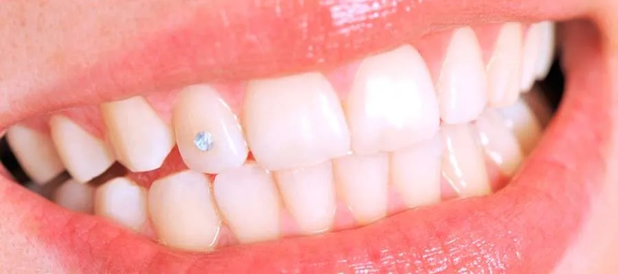 طب الأسنان التجميلي الوردي