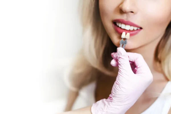 Why Veneers in Turkey